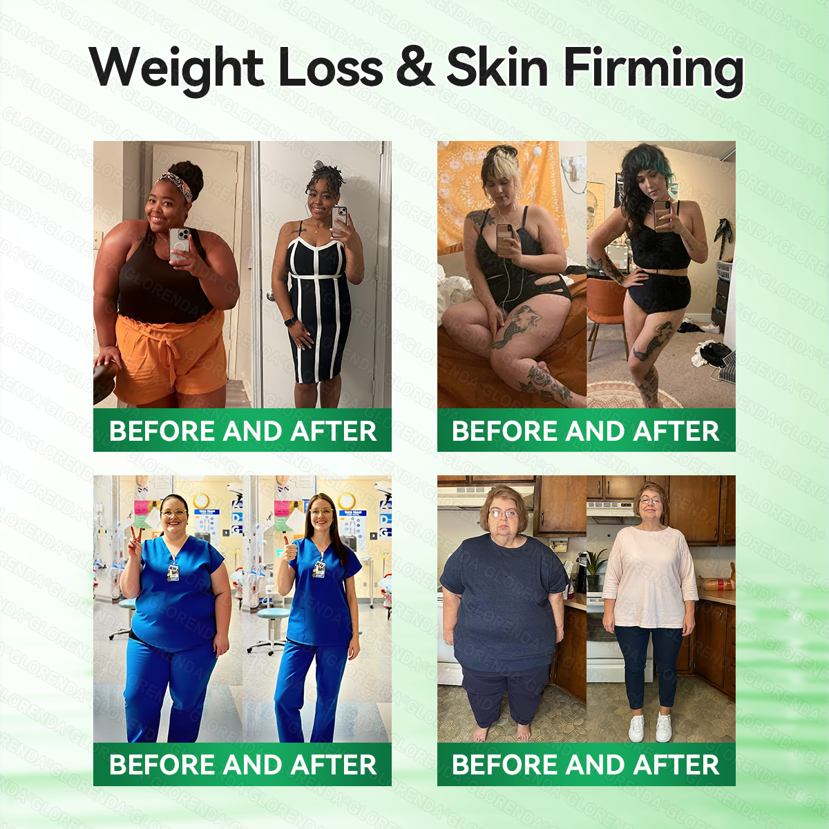 🇬🇧𝑶𝒇𝒇𝒊𝒄𝒊𝒂𝒍 𝑺𝒕𝒐𝒓𝒆  | 👨‍⚕️𝐆𝑳𝑶𝗥𝗘𝗡𝘿𝘼® 𝙈𝒐𝒓𝒊𝒏𝒈𝗮 · 𝗕𝗲𝗿𝗯𝐞𝐫𝐢𝐧𝙚 × 𝙉𝑨𝑫+ 𝟏𝟎-𝙞𝙣-1 𝘼𝒅𝒗𝒂𝒏𝒄𝒆𝐝 𝐍𝐚𝐧𝙤 𝙈𝙞𝙘𝙧𝙤𝙣𝒆𝒆𝒅𝒍𝐞 𝐏𝐚𝐭𝙘𝙝(𝐉𝐮𝐬𝐭 𝐨𝐧𝐜𝐞 𝐚 𝐝𝐚𝐲, 𝐯𝐢𝐬𝐢𝐛𝐥𝐞 𝐜𝐡𝐚𝐧𝐠𝐞𝐬 𝐢𝐧 𝟕 𝐝𝐚𝐲𝐬） ✅ 𝐅𝐨𝐫 𝐨𝐛𝐞𝐬𝐢𝐭𝐲, 🅛🅞🅞🅢🅔 🅢🅚🅘🅝,𝐝𝐢𝐚𝐛𝐞𝐭𝐞𝐬, 𝐬𝐥𝐞𝐞𝐩 𝐚𝐩𝐧𝐞𝐚, 𝐣𝐨𝐢𝐧𝐭 𝐢𝐬𝐬𝐮𝐞𝐬, 𝐚𝐧𝐝 𝐦𝐨𝐫𝐞